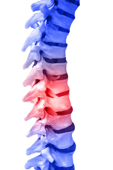 LESIONES MEDULARES